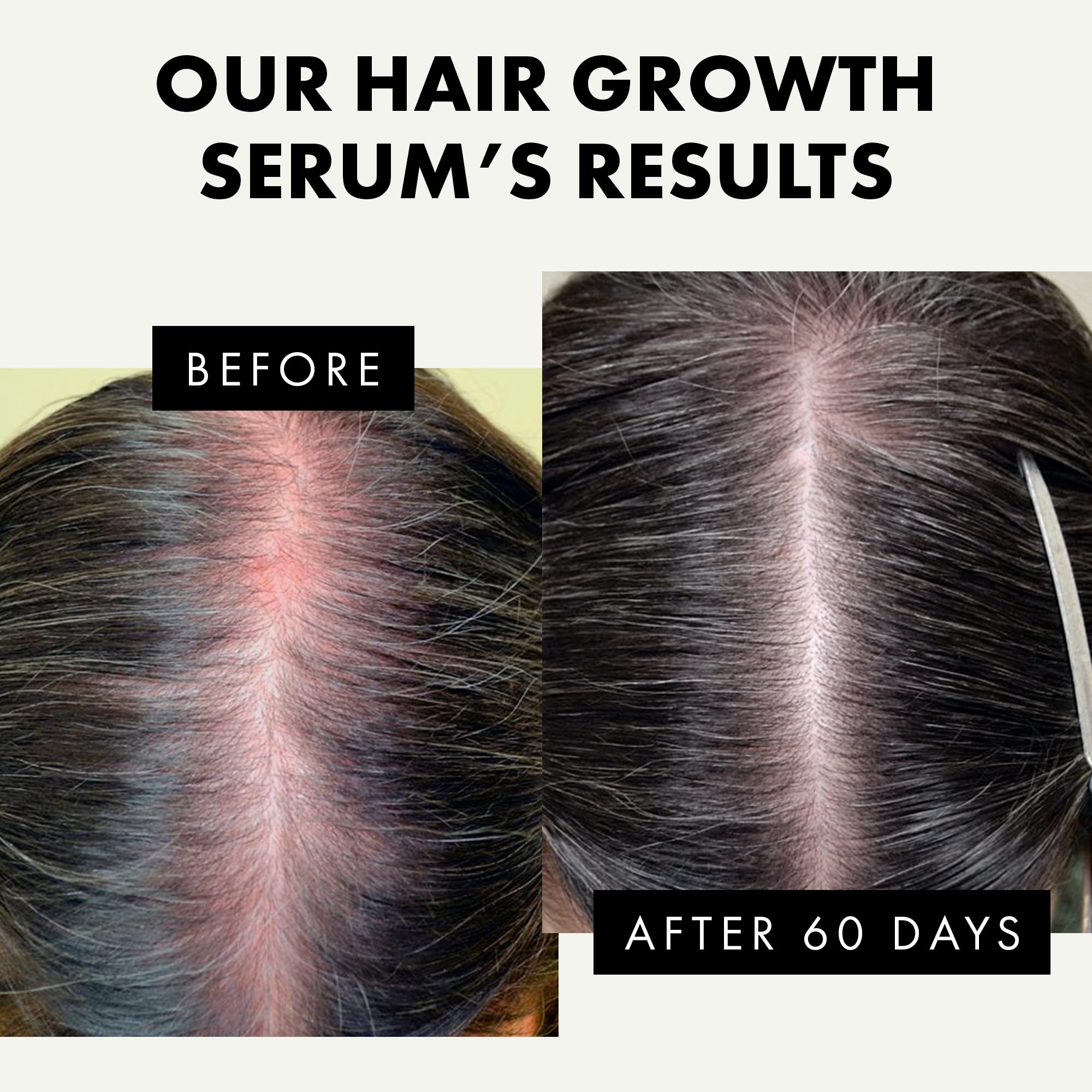 Biotin Hair Growth Serum for Dry Damaged & Frizzy Hair - Sulfate Free Vegan Anti-Frizz Treatment Oil for Men & Women - Perfect for Daily Use, Salon Styling & Heat Protection