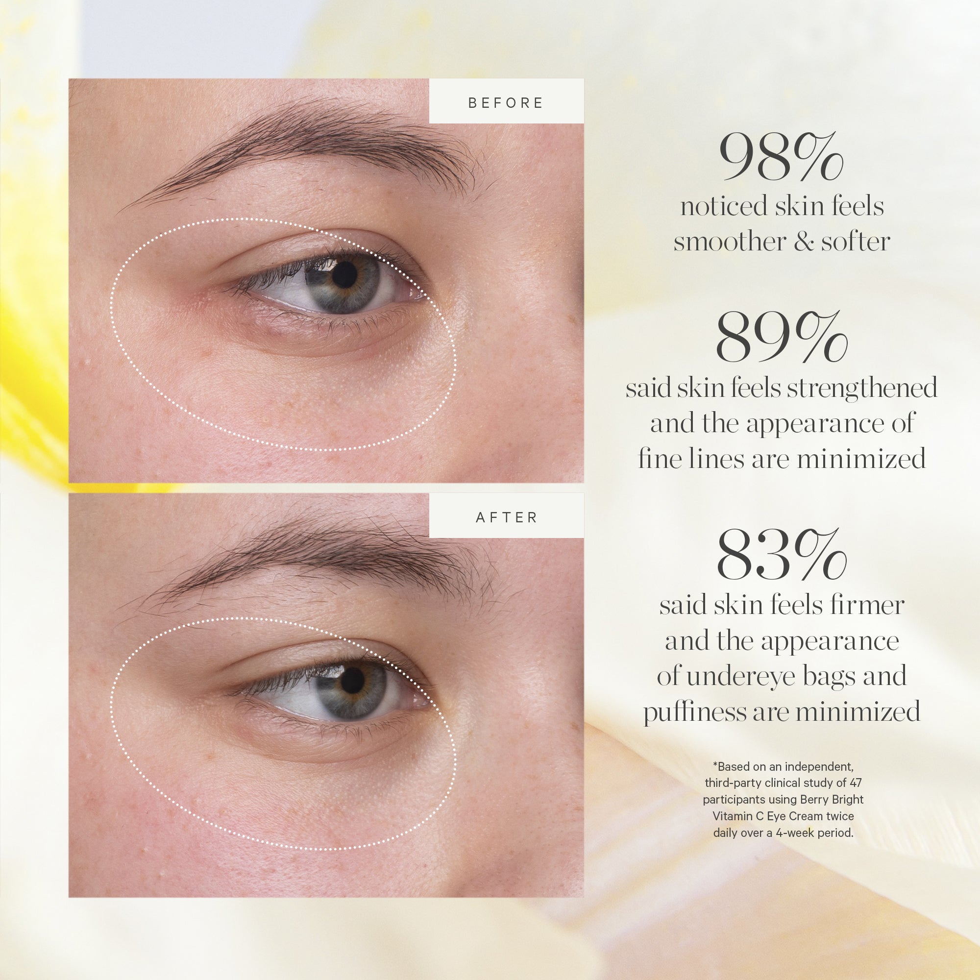 Berry Bright Vitamin C Eye Cream for Dark Circles & Puffiness - Brightening & Hydrating Under Eye Treatment - Day & Night Use for Women & Men