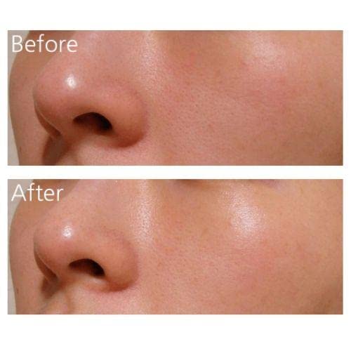 DearKlairs Supple Preparation Unscented Toner 180ml & Rich Moist Soothing Serum 80ml Set - Hydrating Korean Skincare Routine for Dewy Glow | Daily Moisturizing Face Care for Dry & Sensitive Skin | Perfect for Morning & Nighttime Skincare Regimen