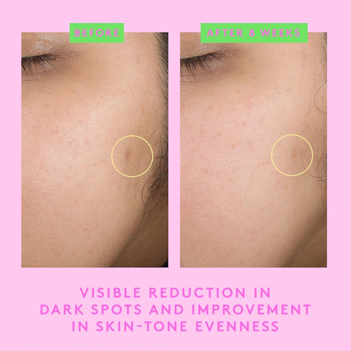 B Goldiâ¢ Illuminating Drops with Niacinamide by Drunk Elephant - Brightening Serum for Glowing Skin, Day & Night Skincare Routine