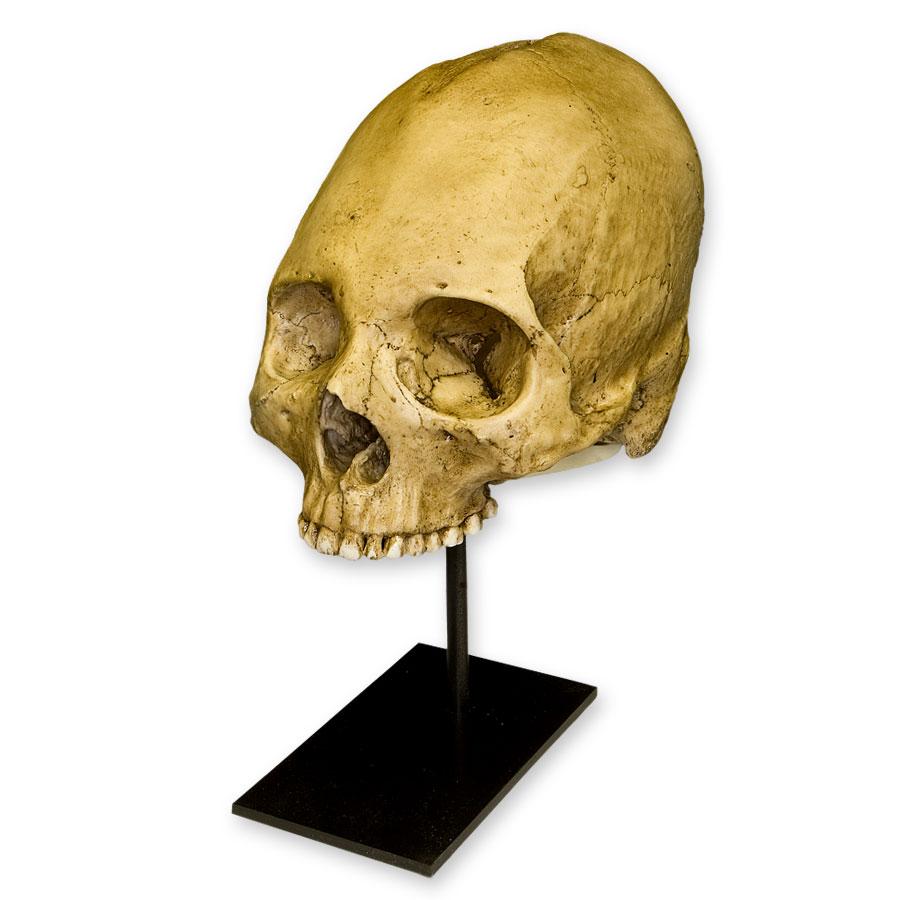 Authentic Replica Human Skull with Trephination - Perfect for Medical Study, Halloween Decor & Gothic Collectors