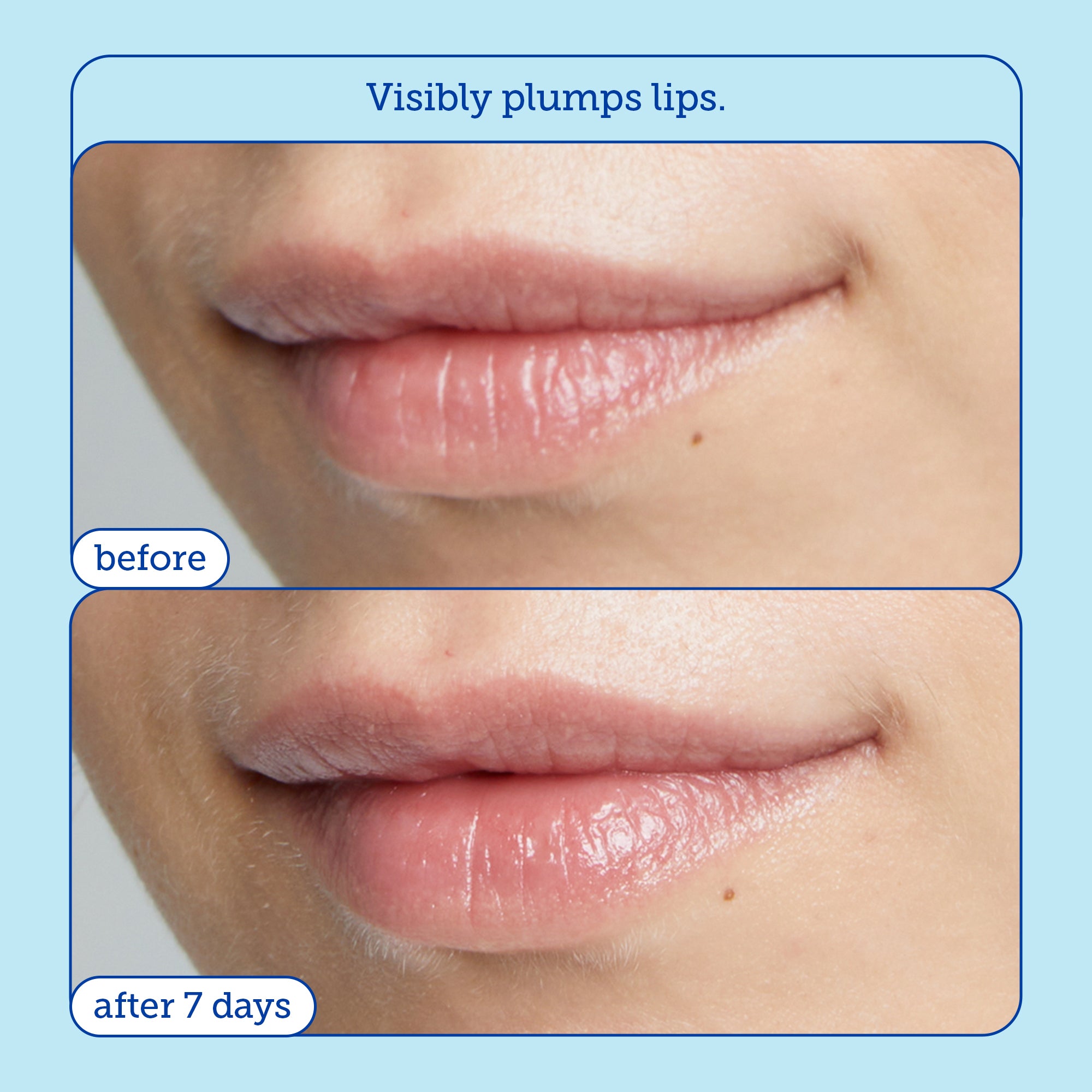 Barrier+ Triple Lipid Lip Treatment - Hydrating & Repairing Lip Balm for Dry, Chapped Lips | Day & Night Moisturizing Lip Care for All Seasons