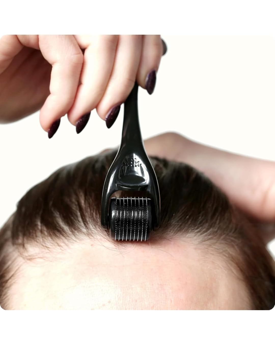 Akhirah 2-Piece 0.5mm Derma Roller with 540 Titanium Needles for Hair Growth & Thickening | Repairs Damaged Hair, Activates Follicles | Reduces Acne Scars | Safe & Effective Skincare & Hair Care Tool | Perfect for Home Use & Salon Treatments - Pack of 2
