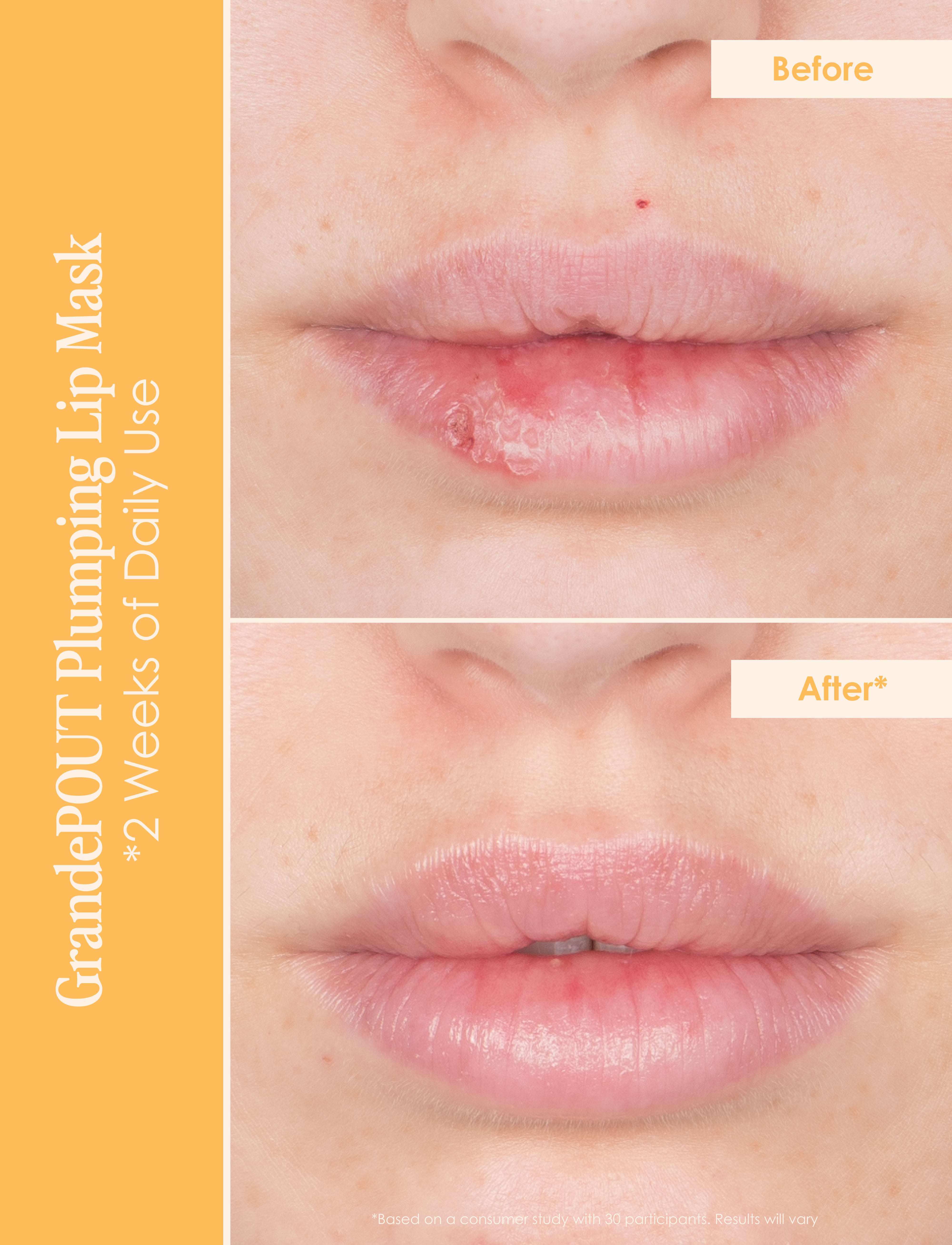 GrandeLIPS & GrandePOUT - Lip Plumper & Enhancer for Fuller, Voluminous Lips - Perfect for Daily Wear, Special Occasions, and Makeup Looks