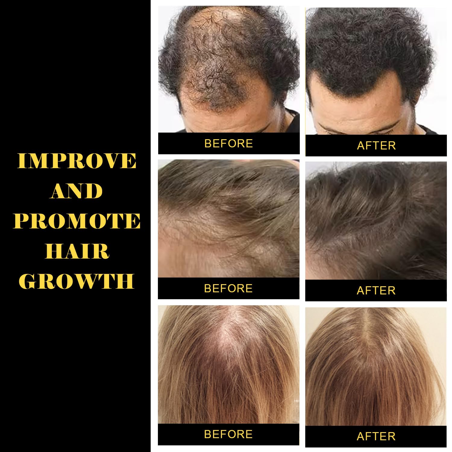 Chebe Hair Growth Oil with Chebe Powder - Natural Scalp Treatment for Thicker, Stronger & Longer Hair - Hair Thickening Products for Women & Men - Perfect for Daily Hair Care & Styling Routine