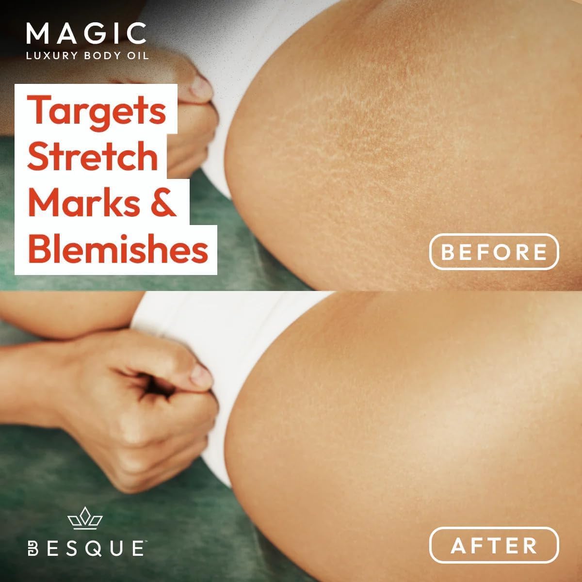 Magic Body Oil for Women - 3.38 FL OZ Hydrating & Firming Skin Care with Natural Ingredients, After Shower Moisturizer to Plump & Tighten Skin, Luxury Spa Gift Set (Pack of 2) - Perfect for Post-Shower Hydration, Daily Skincare Routine & Relaxing Spa Nights at Home