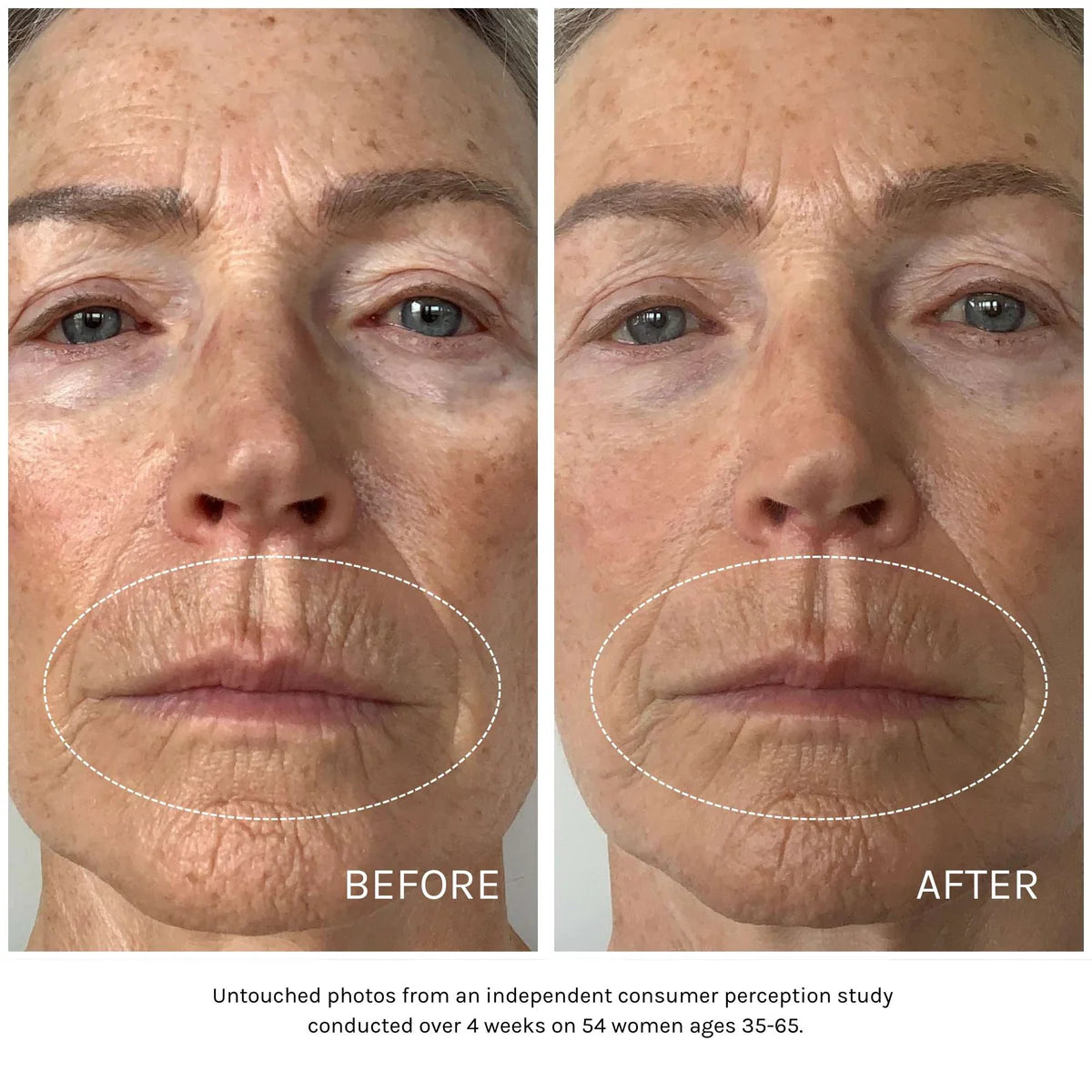 Best Essential Peptide Serum for Anti-Aging & Skin Repair - Hydrating Facial Treatment for Wrinkles & Fine Lines | Day & Night Use