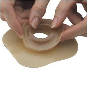 Adapt 79530 Convex Barrier Ring (10-Pack) - Ideal for Ostomy Care, Skin Protection & Comfortable Wear All Day