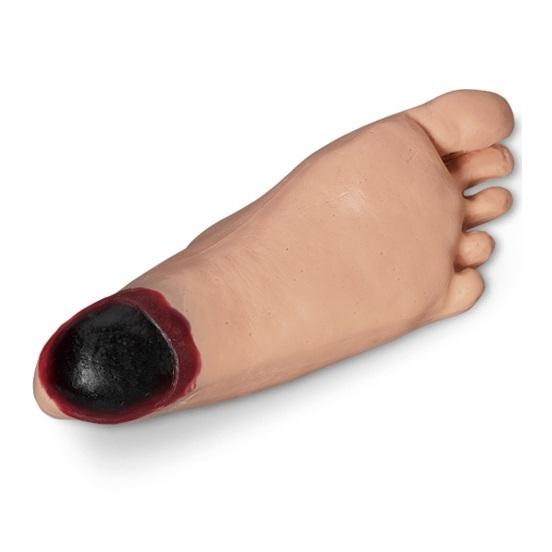 GERi™ KERi™ Edema Relief Socks for Swollen Feet with Tissue Damage - Light Skin Tone - Comfortable Compression for Lymphedema, Post-Surgery & Diabetic Foot Care