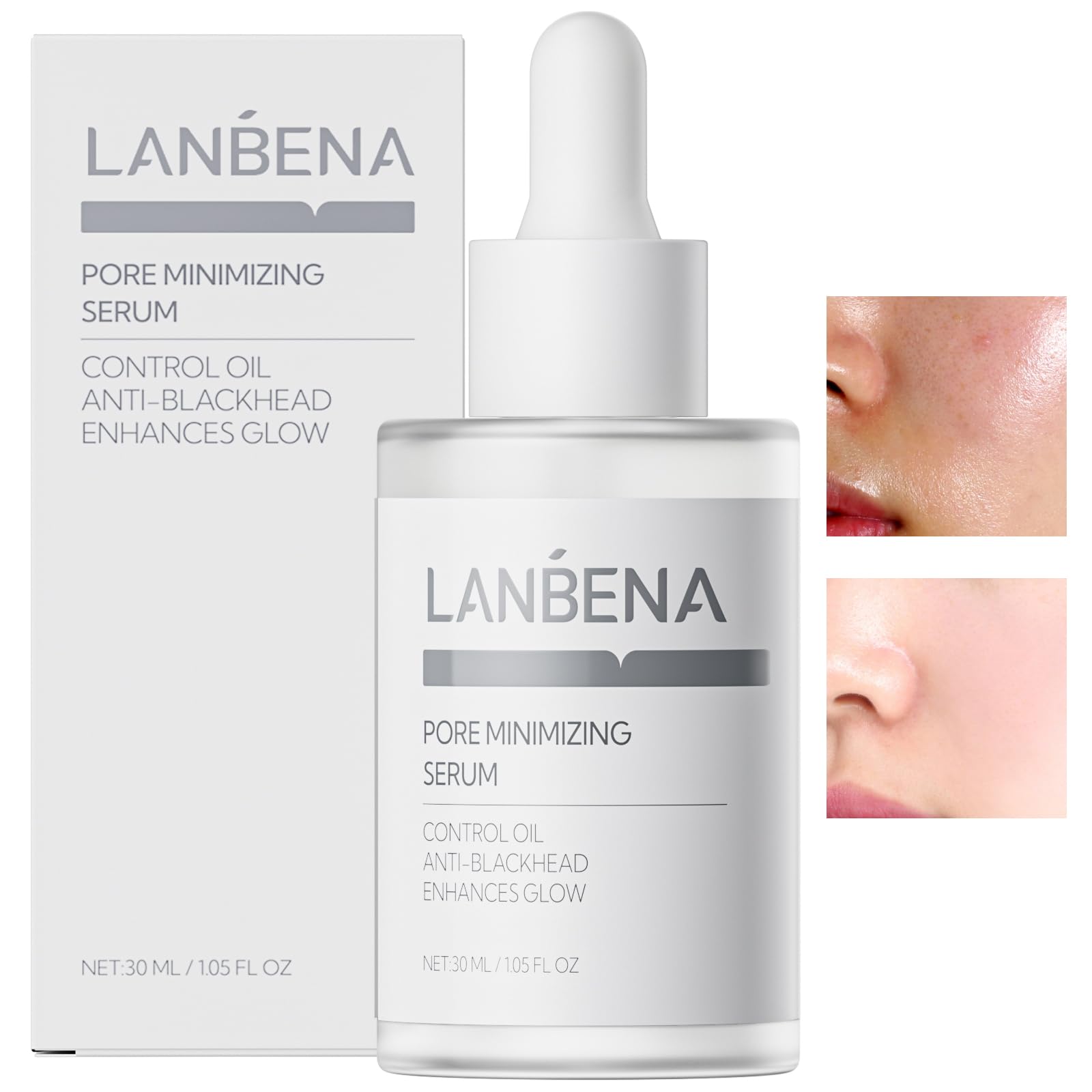LANBENA Pore Minimizer Serum 2.0 - Facial Essence for Shrinking Pores, Oil Control & Moisturizing | Skin Care Treatment for Dryness Relief & Firming | 30ML | Perfect for Post-Blackhead Removal & Daily Skincare Routine