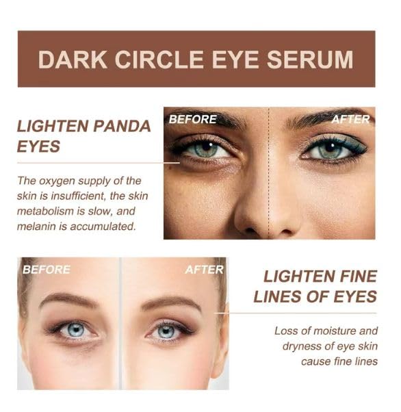 YELURI Dark Circle Eye Serum - Brightening & Anti-Aging Eye Treatment for Puffiness & Wrinkles (30ml) | Day & Night Use for Tired Eyes | Cruelty-Free Skincare
