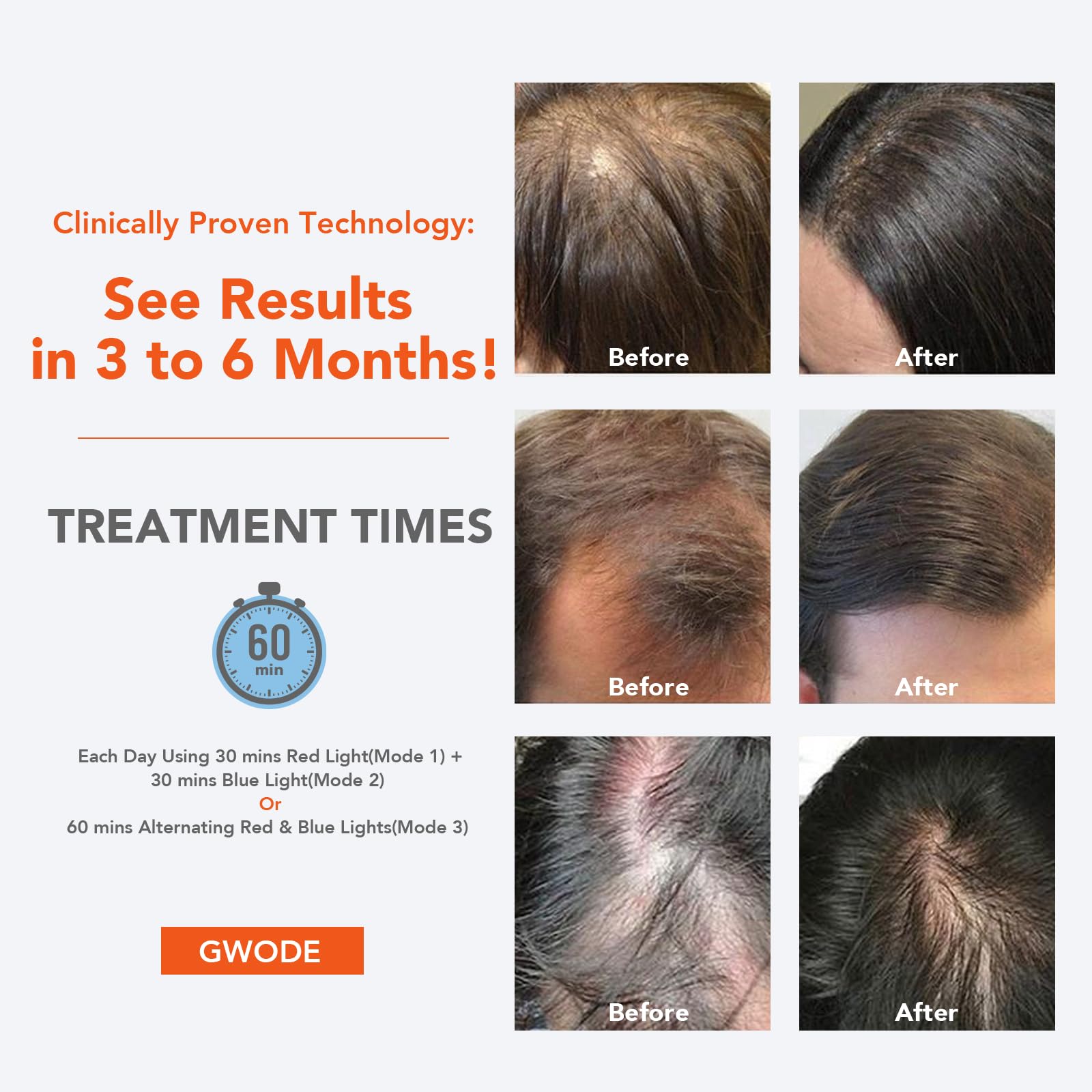 Laser Hair Growth Cap for Hair Regrowth - FDA Cleared Red Light Therapy Cap for Thinning Hair & Hair Loss Treatment - At Home Use for Men & Women