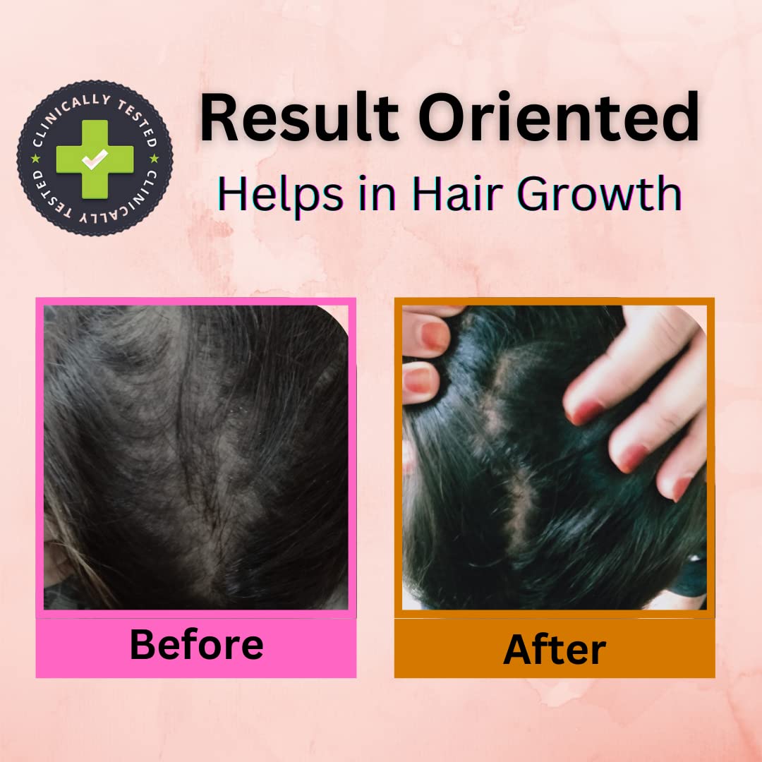 Arnica & Jaborandi Hair Growth Oil - Strengthen & Shine Hair Naturally | Fast Hair Growth Treatment for Thicker, Healthier Locks | Perfect for Daily Scalp Massage & Damaged Hair Repair