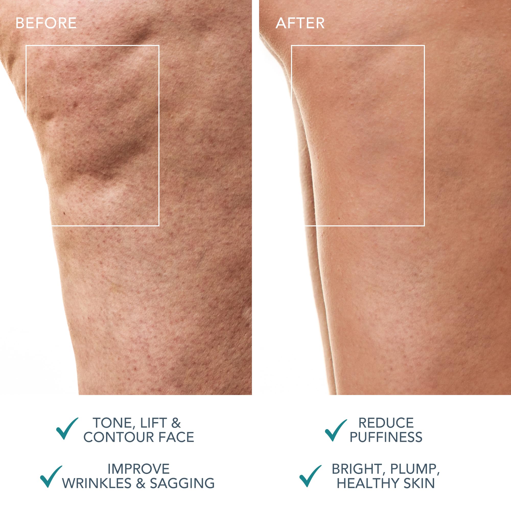 FOREO Bear 2 Body Advanced Microcurrent Body Sculpting Machine for Cellulite Reduction & Lymphatic Drainage - Skin Firming & Contouring Massager - Enhances Skincare Absorption - Perfect for Home Spa & Body Sculpting Routine