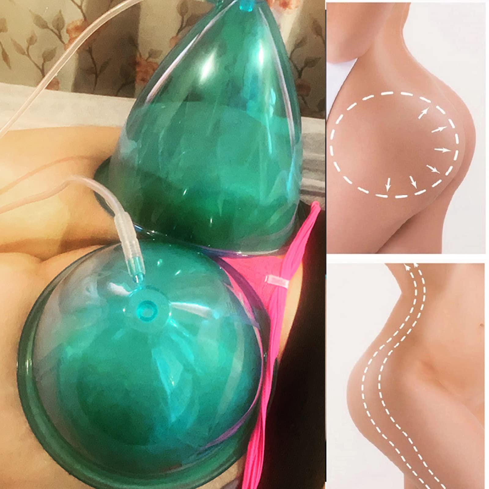180ml Vacuum Cupping Therapy Set - 6pcs Butt Lifting Suction Cups with Y-Hose for Body Sculpting, Cellulite Reduction & Pain Relief - Perfect for Home Spa, Massage Therapy & Beauty Treatments
