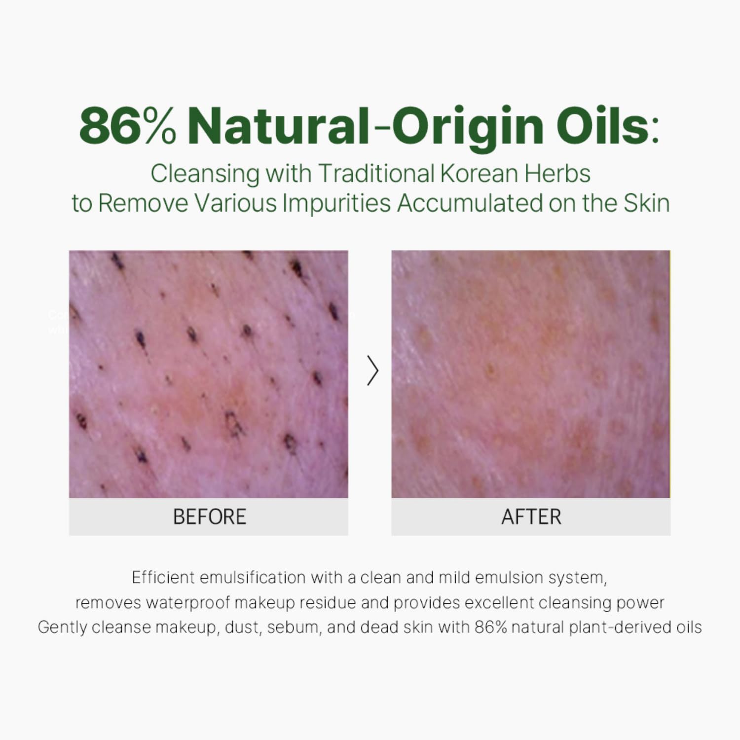 Ariul Apple Cider Vinegar Cleansing Oil - Hydrating Makeup Remover with Purifying Apple Cider Vinegar for Pore Care | Korean Skincare for Dry & Sensitive Skin | 200ml / 6.76 fl oz | Perfect for Daily Deep Cleansing & Double Cleansing Routine