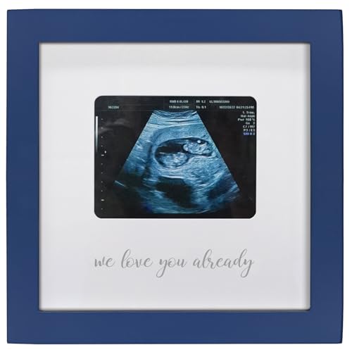 We Love You Already - Blue