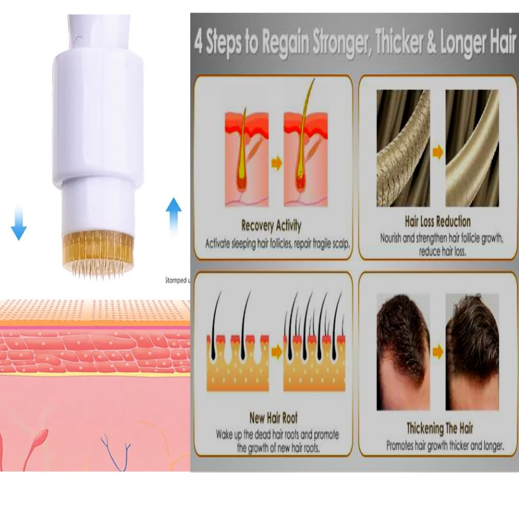 Myora 1.5mm Titanium Derma Roller for Face & Scalp – Professional Microneedling Stamp for Anti-Aging, Acne Scars, Pore Minimization & Hair Growth – At-Home Skin Care Treatment for Women & Men – Perfect for DIY Facial Rejuvenation & Beard Enhancement
