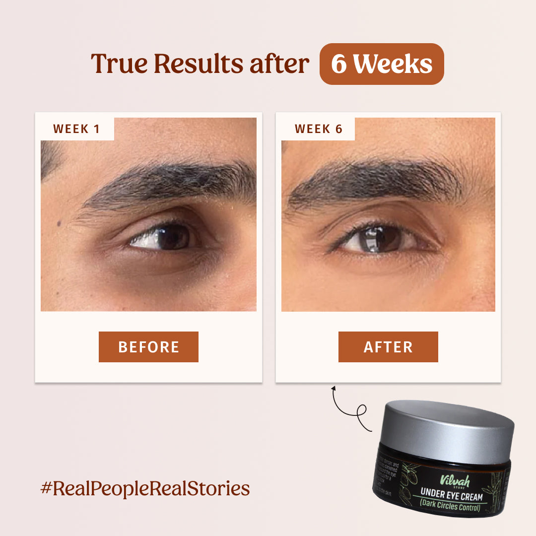 Best Under Eye Cream for Dark Circles - Brightening & Hydrating Treatment for Puffy Eyes - Perfect for Night & Day Use