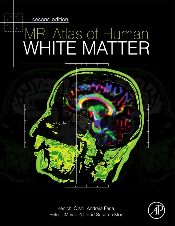 MRI Atlas of Human White Matter - Comprehensive Brain Imaging Guide for Neurologists, Researchers & Medical Students | Study Neuroanatomy & White Matter Tracts