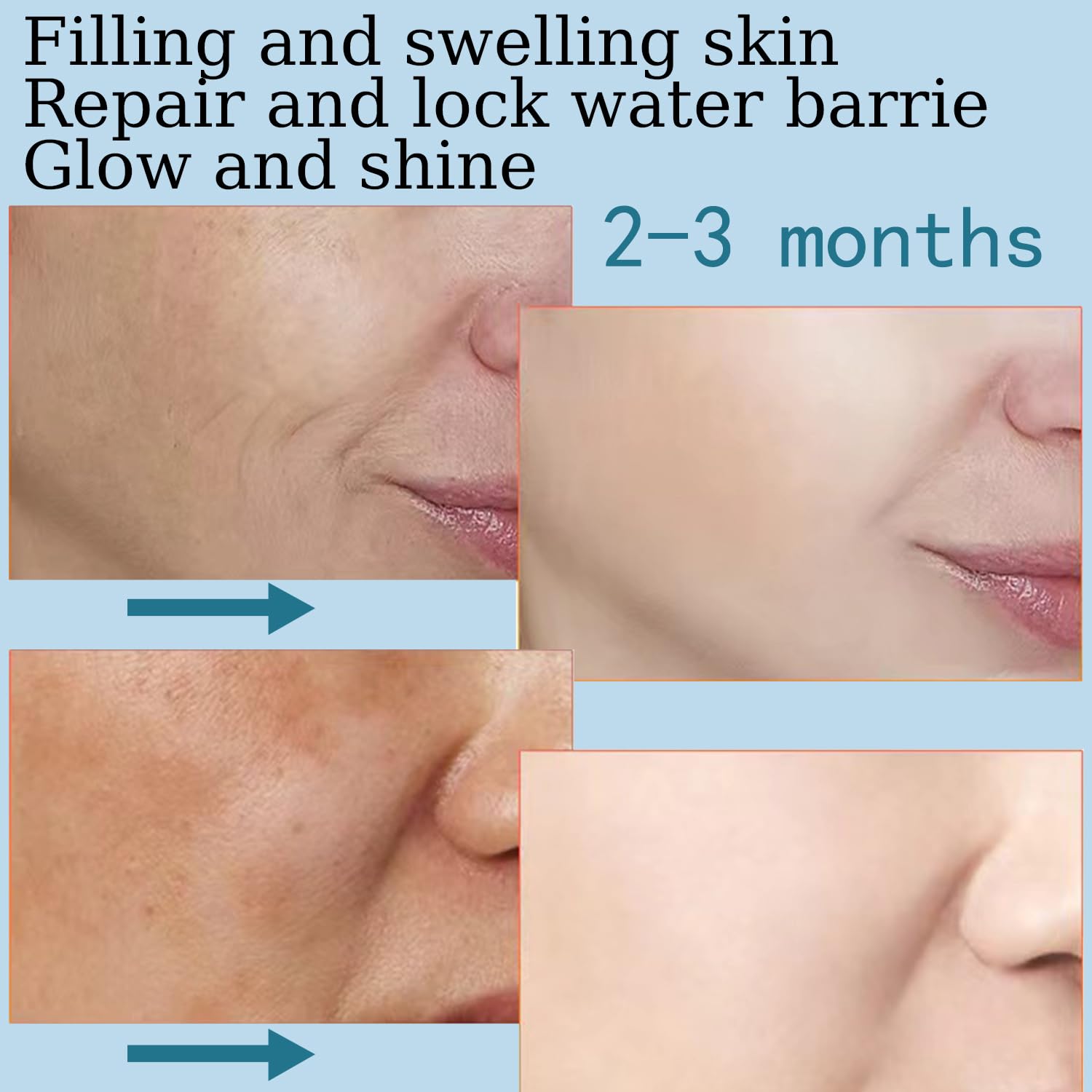 **5% Hyaluronic Acid Serum with Vitamin E - Best Pure Hyaluronic Acid Moisturizer for Face, Anti-Aging & Wrinkle Reduction, Hydrates Fine Lines & Sensitive Skin, Fades Age Spots (30ml) - Perfect for Daily Skincare Routine & Nighttime Hydration**
