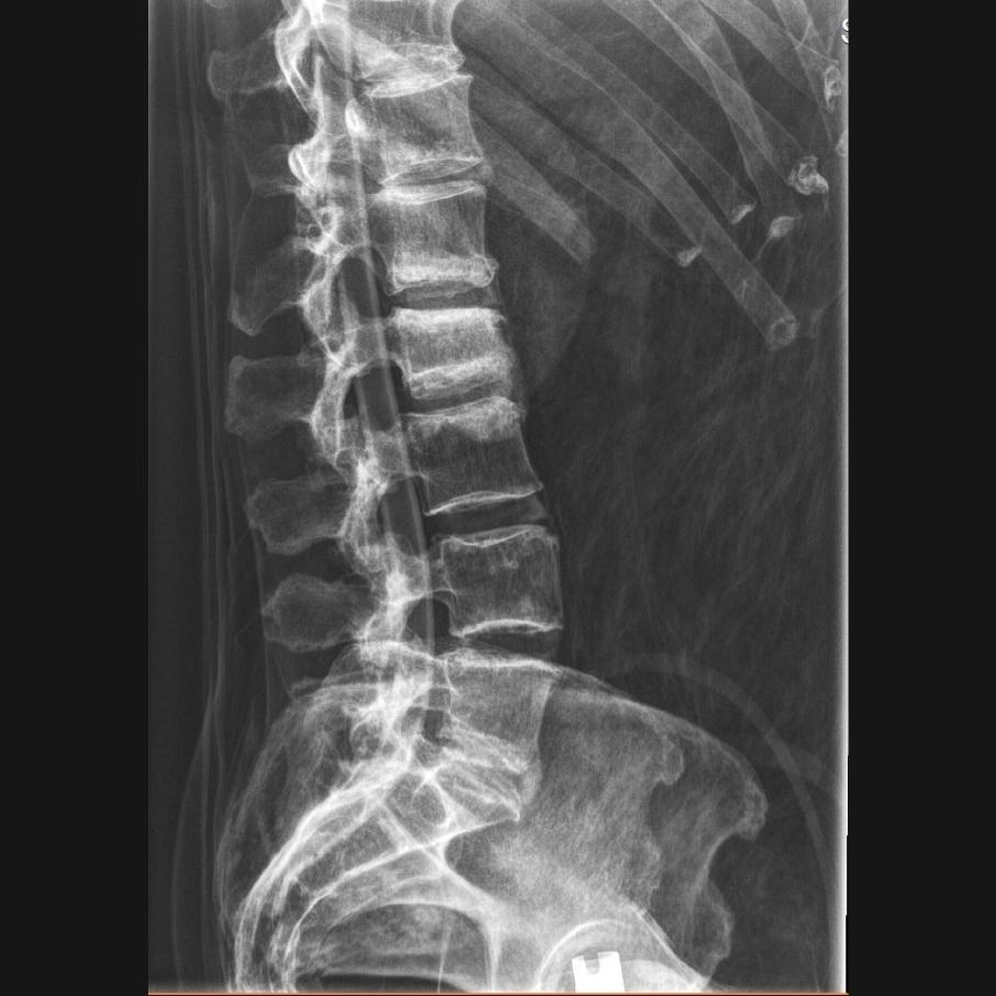 Full Body X-Ray Phantom with Real Human Skeleton Bones - High-Quality Medical Training Model for Radiology, Anatomy Studies & X-Ray Positioning Practice (Ideal for Medical Schools, Hospitals & Research Labs)