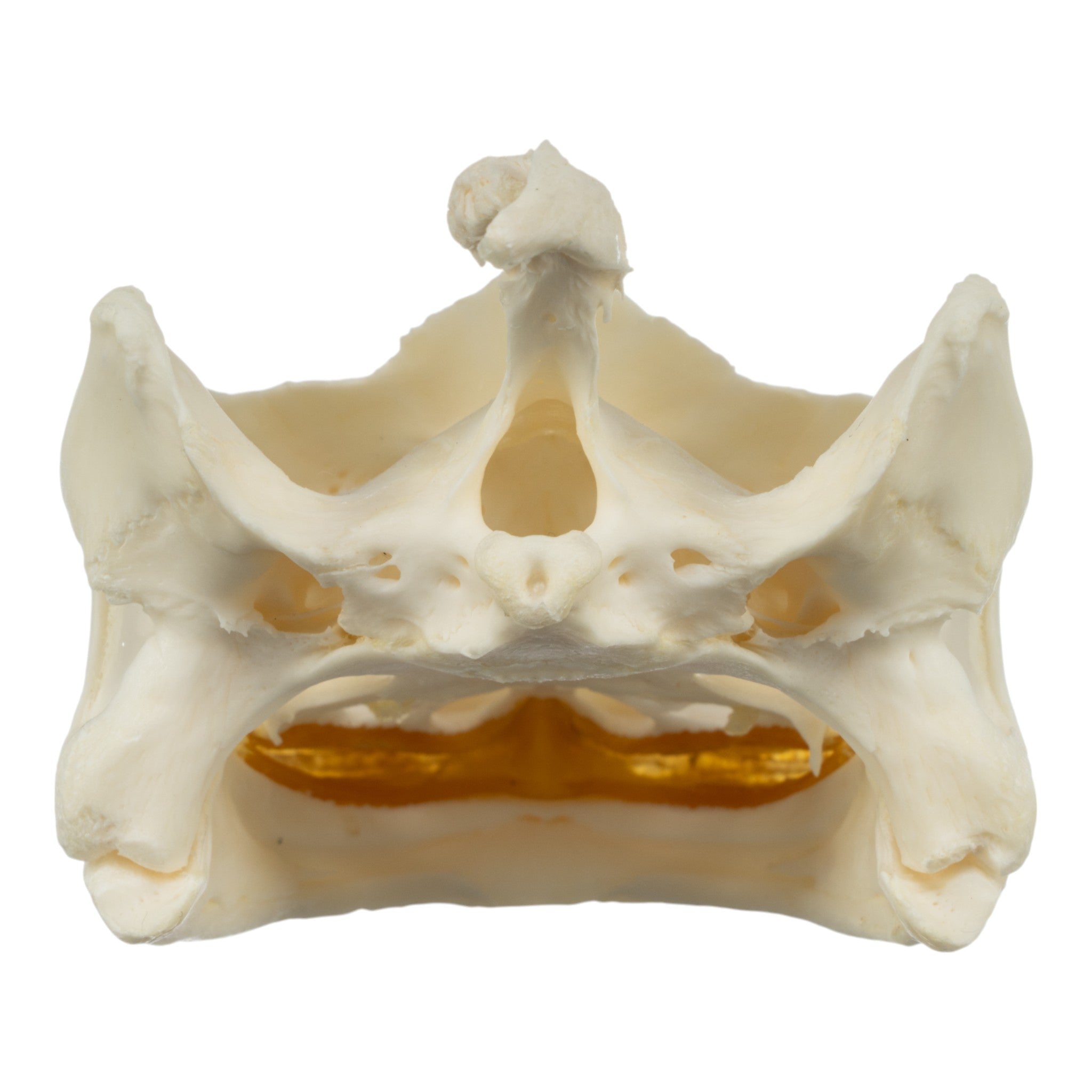 Authentic Large Snapping Turtle Skull with Pathology - Real Animal Skull Specimen for Science Education, Taxidermy & Oddity Collections