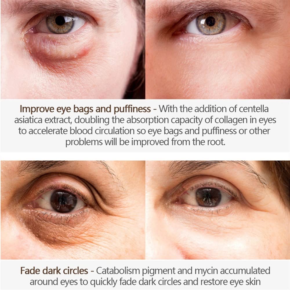 **2023 Best Peptide Lifting Eye Gel for Wrinkles, Dark Circles & Puffiness – Anti-Aging Eye Cream for Firmer Skin (3pcs) – Perfect for Night & Day Use**