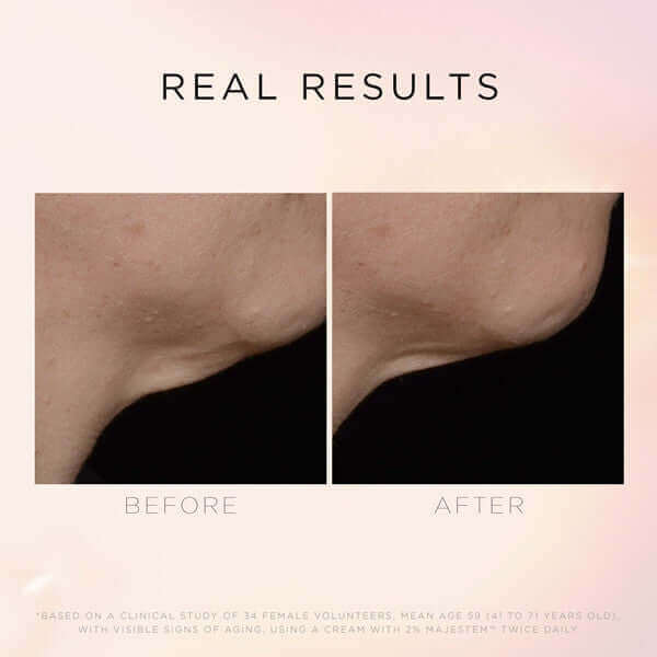 Illuminate & Lift Neck & Décolleté Treatment Cream - Anti-Aging Firming Moisturizer for Wrinkles & Sagging Skin | Perfect for Night Routine & Special Occasion Prep