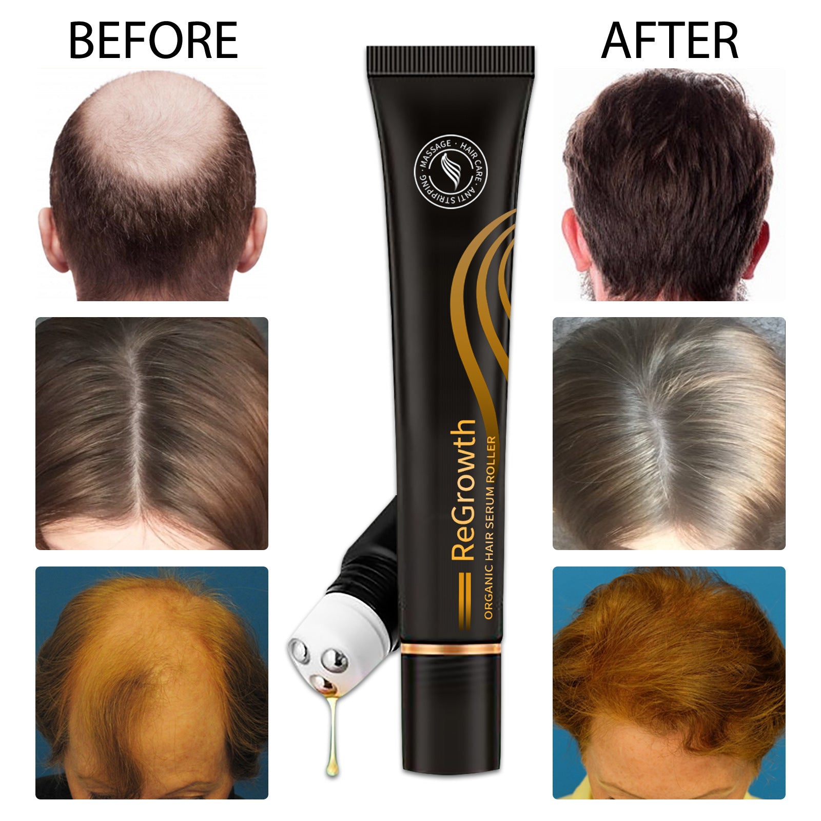 Organic Hair Growth Serum with Roller - Anti-Hair Loss Treatment for All Hair Types, Scalp Nourishing & Strengthening - Perfect for Thinning Hair & Daily Hair Care Routine