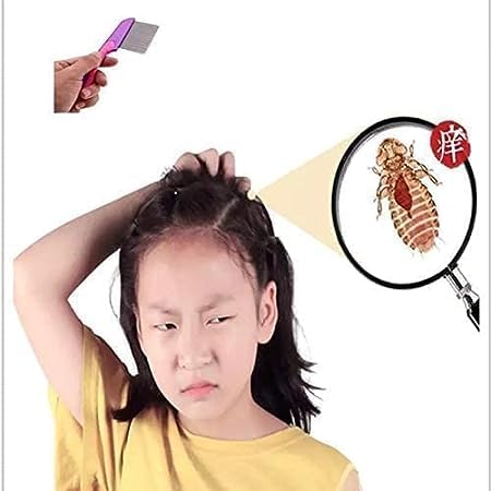 Stainless Steel Lice Comb for Effective Head Lice & Nit Removal - Professional Lice Treatment Tool for Kids & Adults - Perfect for Home, School & Travel Use (U_002)