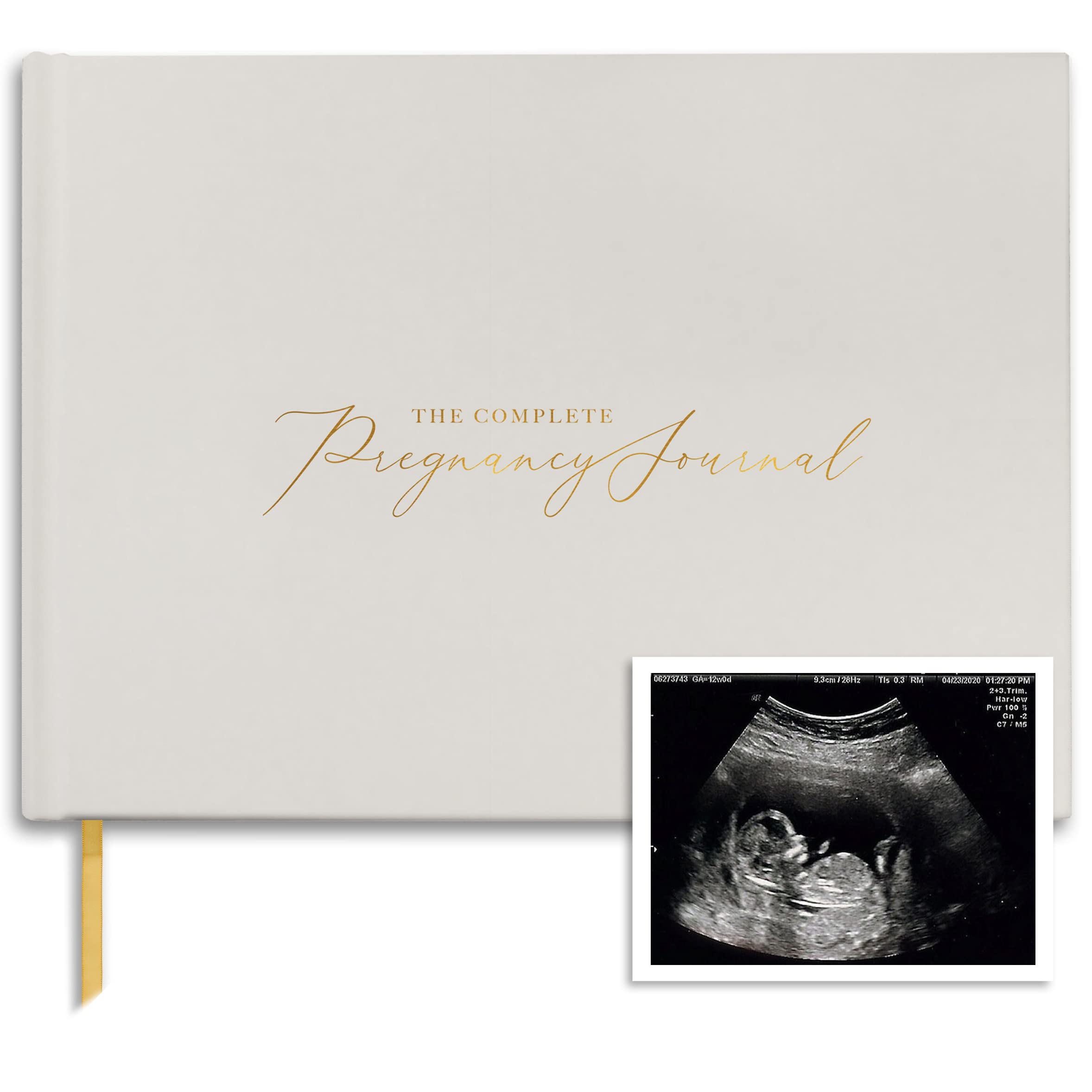 Pregnancy Journal for First-Time Moms - 250 Page Gold Memory Book - Perfect Baby Shower Gift & Pregnancy Diary for Expecting Mothers