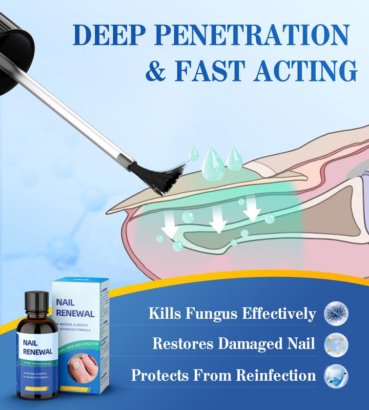 5X Extra Strength Toenail Fungus Treatment with Acetic Acid - Effective Nail Repair for Damaged, Discolored Toenails & Fingernails - Athlete's Foot Relief (1.01oz) - Perfect for Daily Use at Home, Gym, or Travel