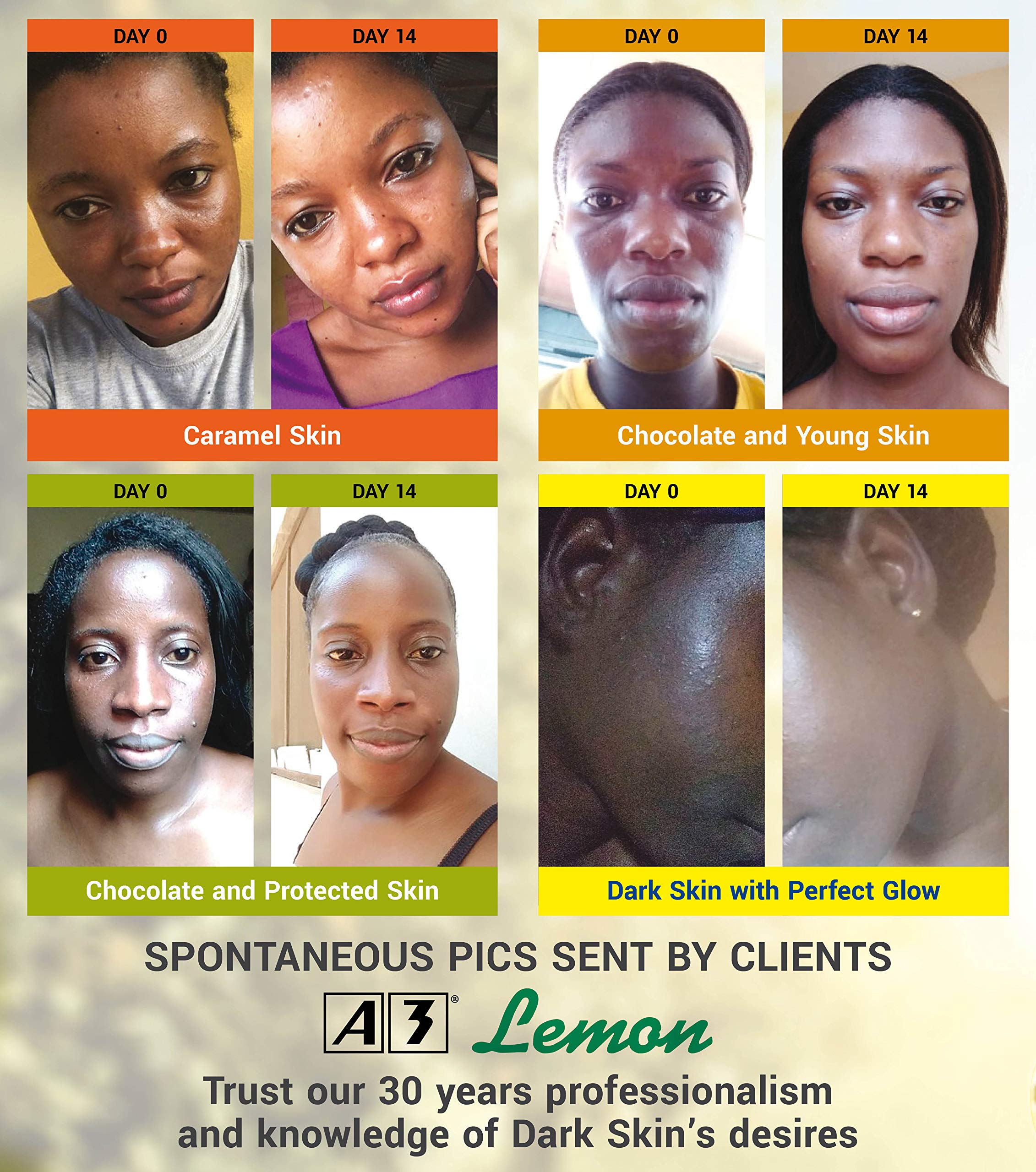A3 Lemon Lotion 4Ever Bright - 400ml Skin Brightening & Moisturizing Cream for Face & Body - Lightens Dark Spots & Evens Skin Tone - Perfect for Daily Skincare Routine & Summer Skin Care