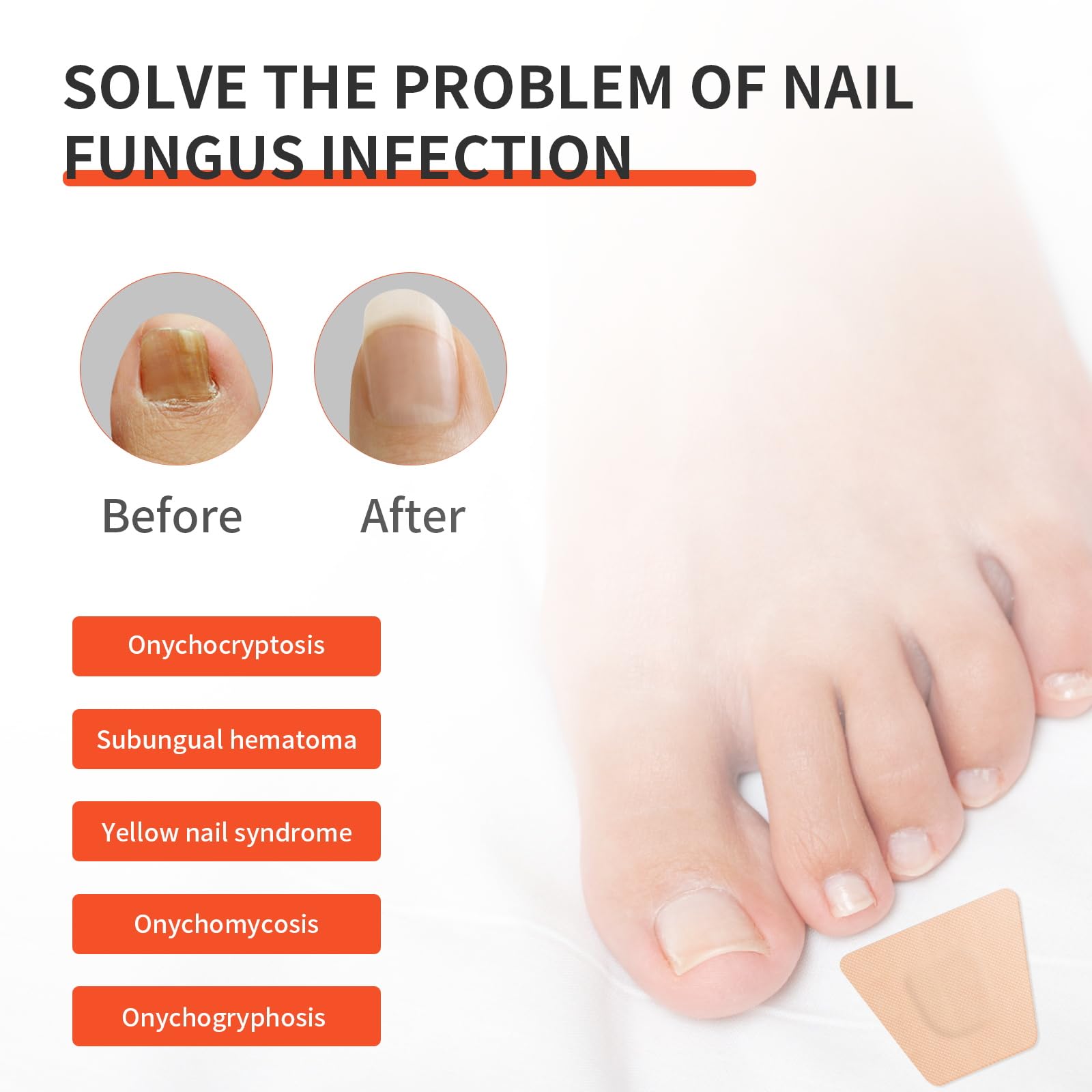 Extra Strength Toenail Fungus Treatment - 32 Pcs Nighttime Renewal Patches for Effective Symptom Relief & Visible Results | Fungal Nail Care for Athletes, Swimmers & Diabetics
