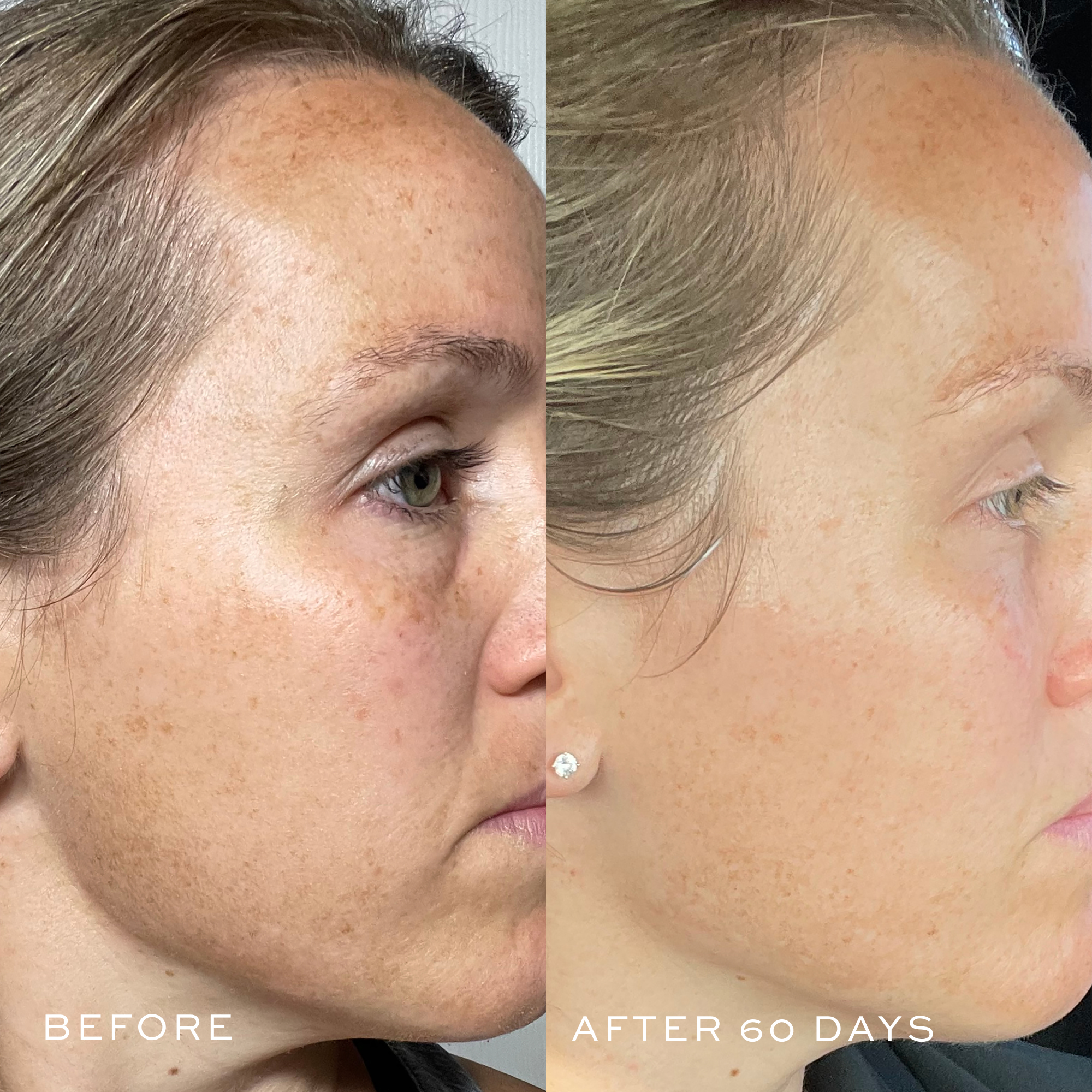 TBT Cream - Skin Brightening & Hydrating Face Moisturizer for Glowing Complexion | Day & Night Use for All Skin Types