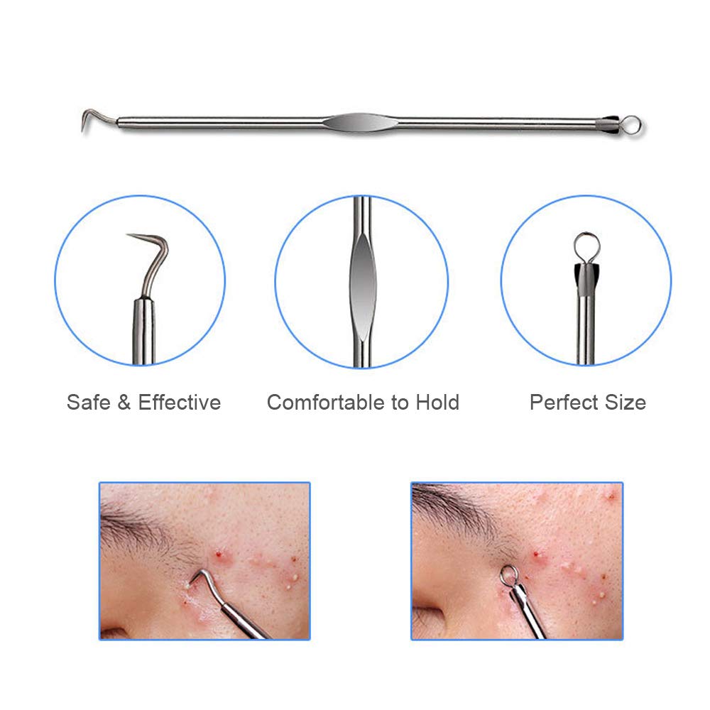4-in-1 Acne Blackhead Remover Kit - Professional Comedone Extractor & Pimple Popper Tool Set for Face, Nose & Skin Care - Perfect for Home Spa & Acne Treatment