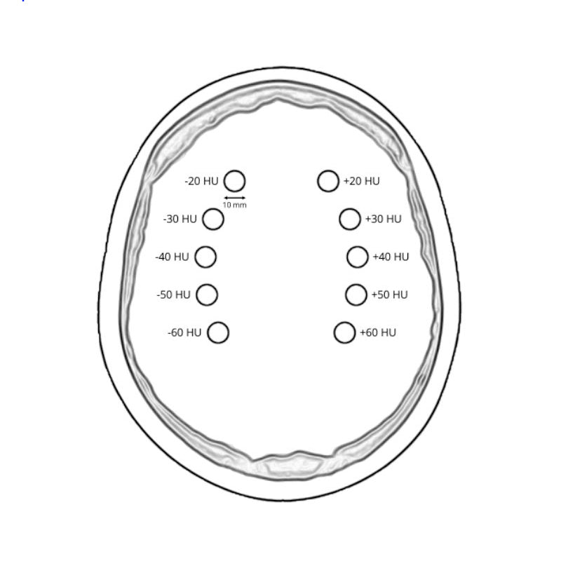 CTA AVM / Lesion Head and Neck Phantom for CT Scan & X-Ray Training - Medical Imaging Practice, Radiology Education, and Diagnostic Procedure Simulation