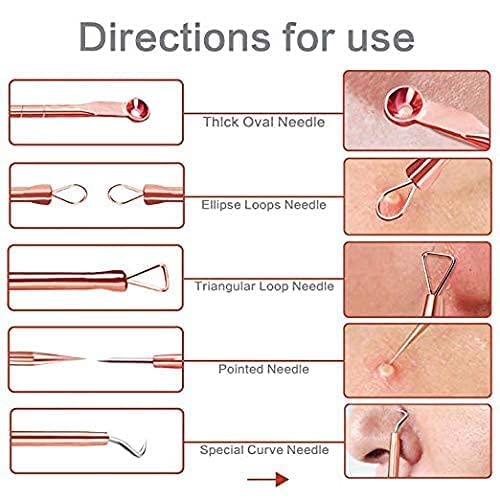 **Professional 4-Piece Blackhead & Pimple Remover Kit - Golden Acne Extractor Tools for Face, Comedone Tweezers for Blackhead Removal - Perfect for Home Skincare & Spa Treatments**