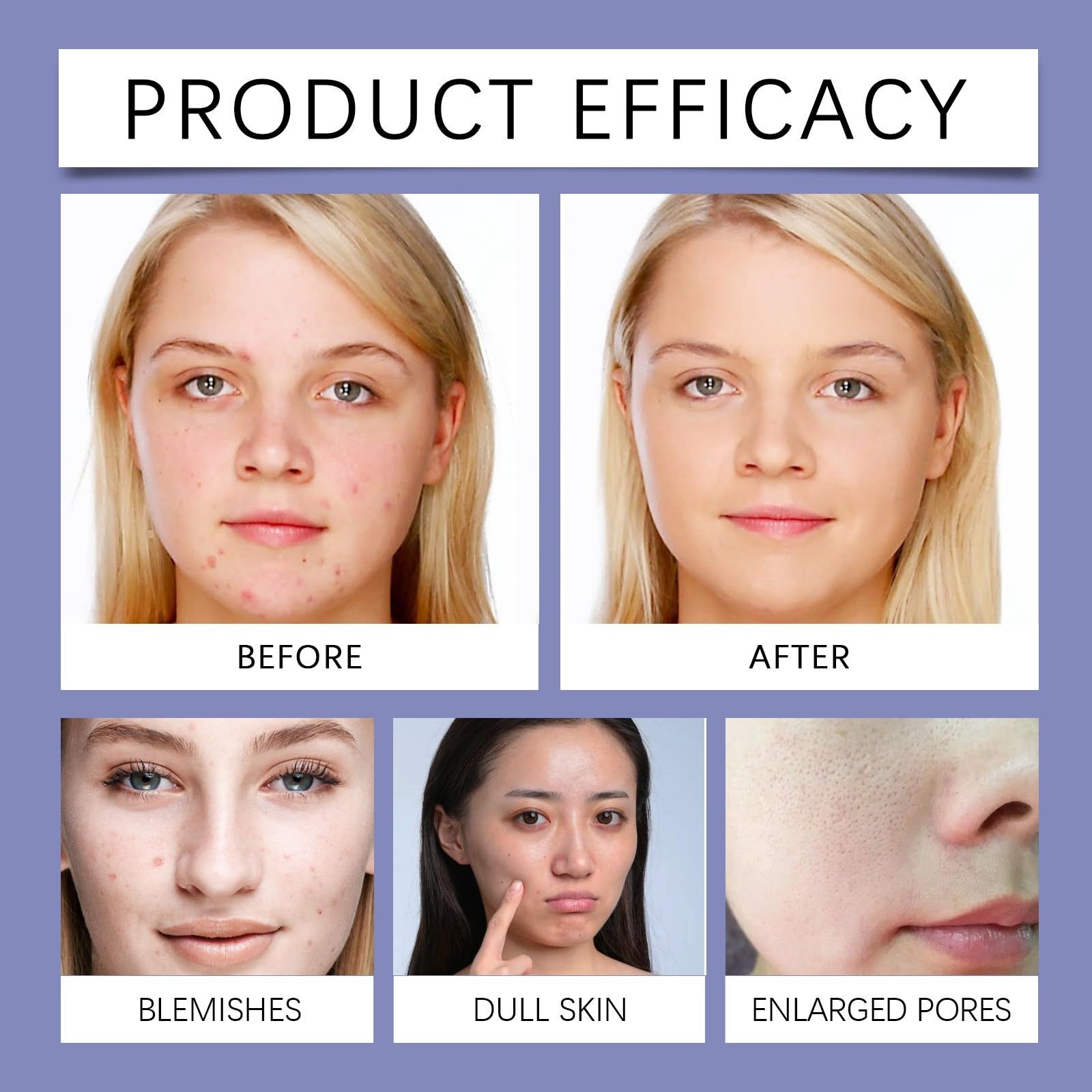 Best Exfoliating Face Wash for Oily Skin - Gentle Daily Cleanser Removes Dirt & Oil Without Over-Drying | Perfect for Morning & Night Skincare Routine