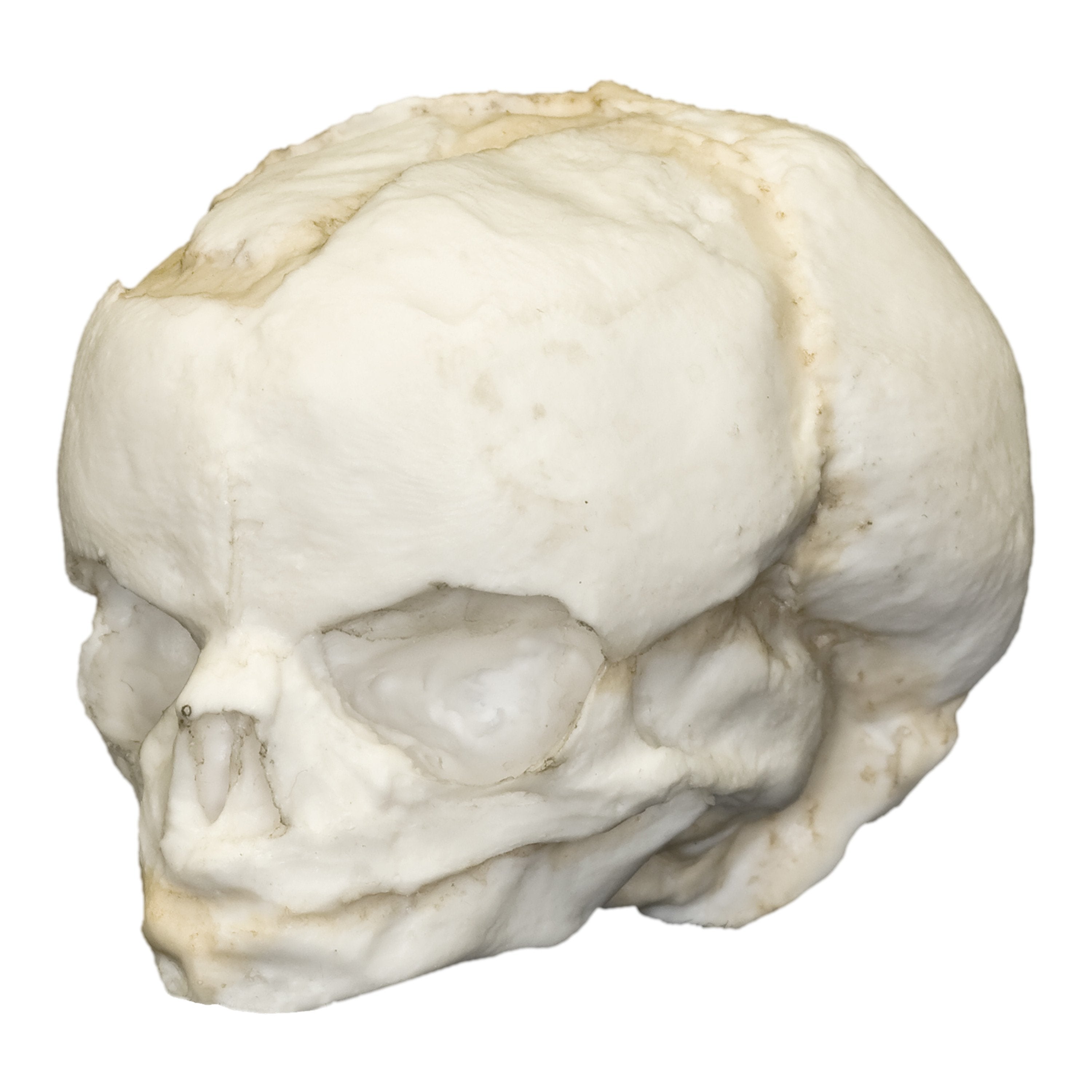Authentic Replica Human Fetal Skull Model - 17 Weeks Gestation for Medical Education & Anatomy Study - Perfect for Classroom, Lab & Research Use