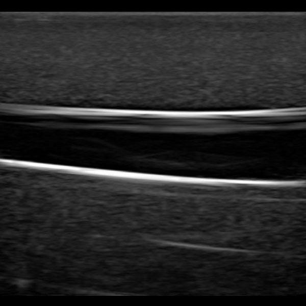 Gen II PICC with IV & Arterial Line Vascular Access Ultrasound Trainer - Medical Simulation for Ultrasound Guided PICC Insertion, X-Ray Positioning Practice & IV Therapy Training