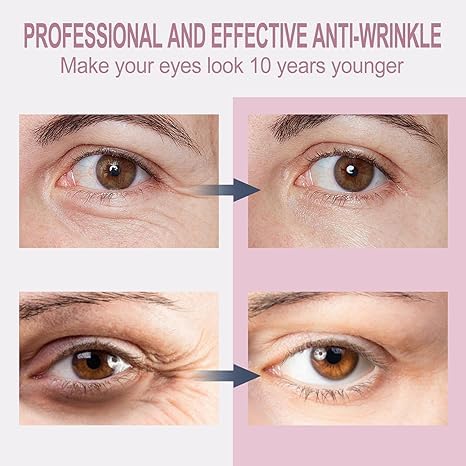 Best Temporary Eye Tightener Cream - Instant Under Eye Bags & Dark Circles Treatment - Anti-Aging Eye Cream with Retinol & Hyaluronic Acid - Reduces Wrinkles & Fine Lines - 0.68 oz - Perfect for Morning Routine & Night Care