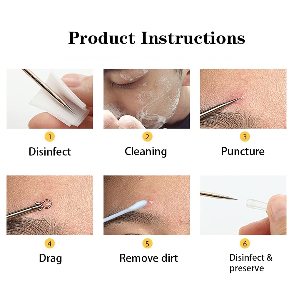 4-Piece Stainless Steel Blackhead Remover Kit - Pimple Popper, Comedone Extractor & Whitehead Removal Tools for Nose & Face | Acne Treatment & Skincare Routine