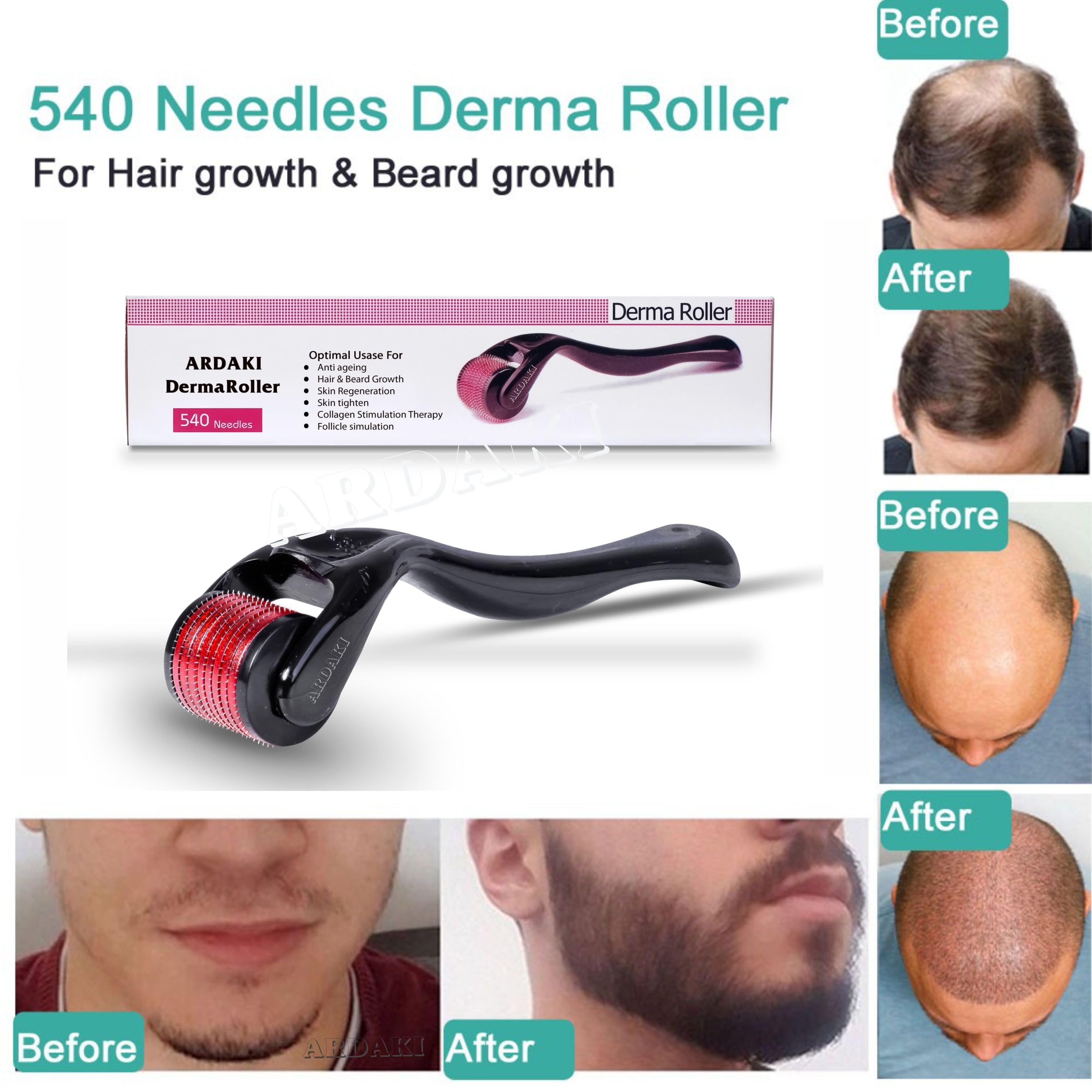ARDAKI 0.5mm Derma Roller for Hair Growth with 540 Titanium Needles - Hair Regrowth Treatment for Thinning Hair, Stimulates Hair Follicles & Repairs Damaged Hair | Perfect for Men & Women at Home Hair Care Routine