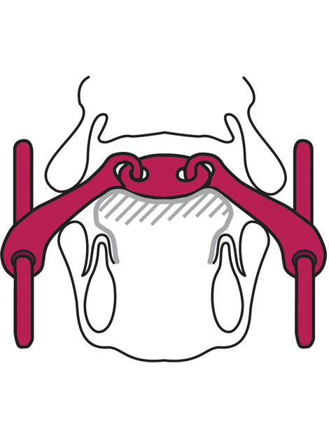 KK Ultra Loose Ring Snaffle 18mm Mouthpiece - Comfortable Horse Bit for Dressage & Training - Perfect for English Riding, Jumping & Equestrian Sports