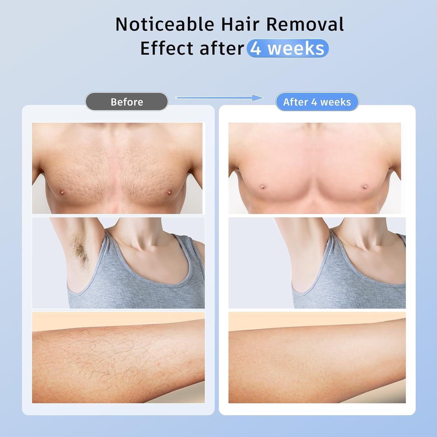 Ubroo IPL Laser Hair Removal Device for Women & Men - 3-in-1 Painless Hair Remover with 5℃ Ice Cooling Technology, Permanent Epilator for Face & Body (Blue) | At-Home Hair Removal Solution for Smooth Skin