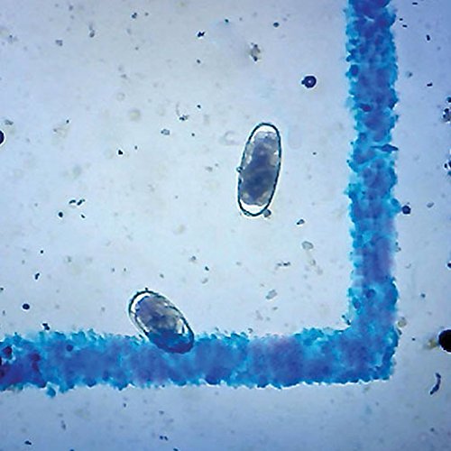 Eggzamin Professional Microscope Kit for Fecal Egg Count - Binocular Microscope with Accessories for Livestock Parasite Testing | Includes Step-by-Step Guide | Ideal for Farmers, Veterinarians & Animal Health Monitoring
