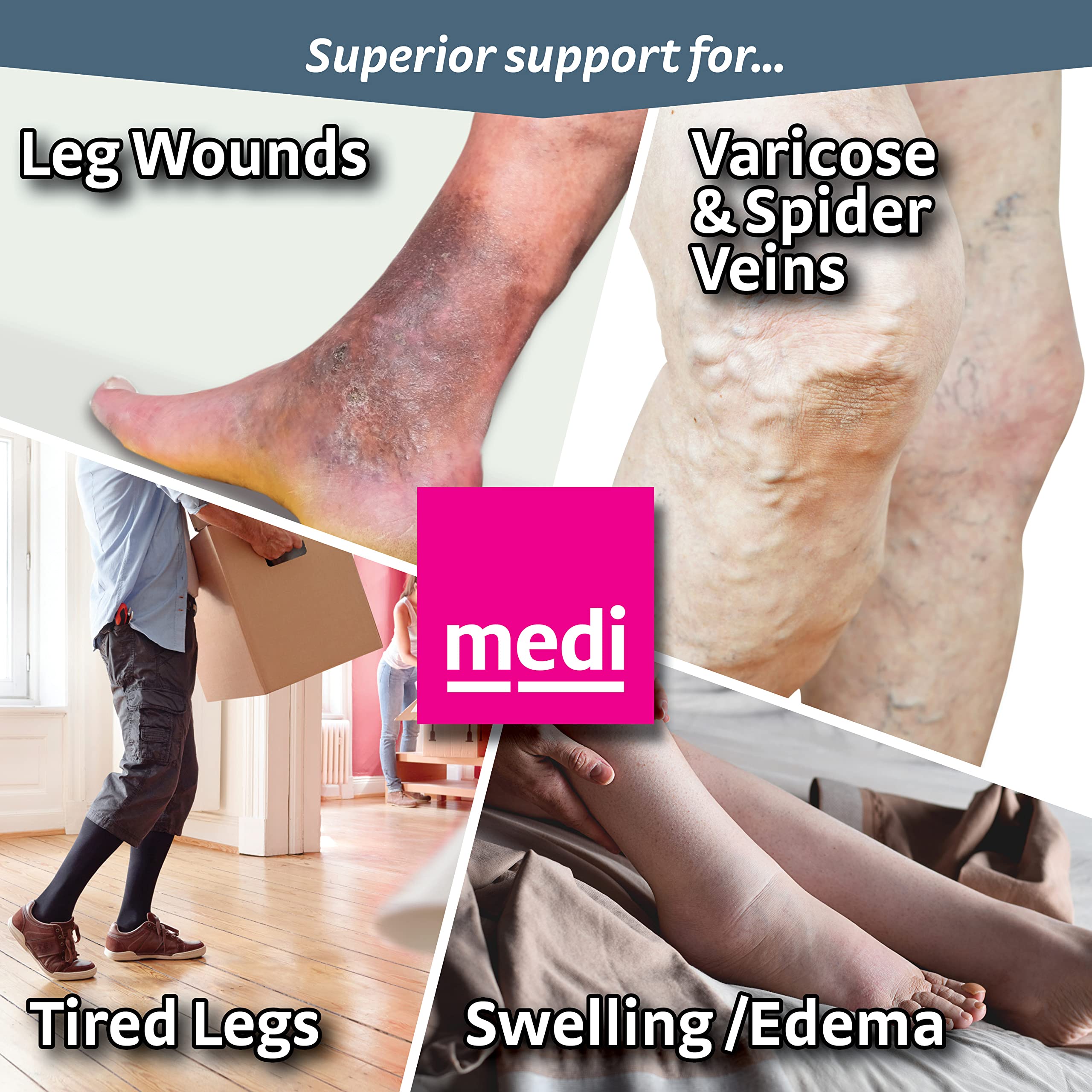 Mediven Plus 20-30 mmHg Compression Stockings for Men & Women - Closed Toe Thigh High Medical Support Socks - Ideal for Varicose Veins, Lymphedema & Post-Surgery Recovery
