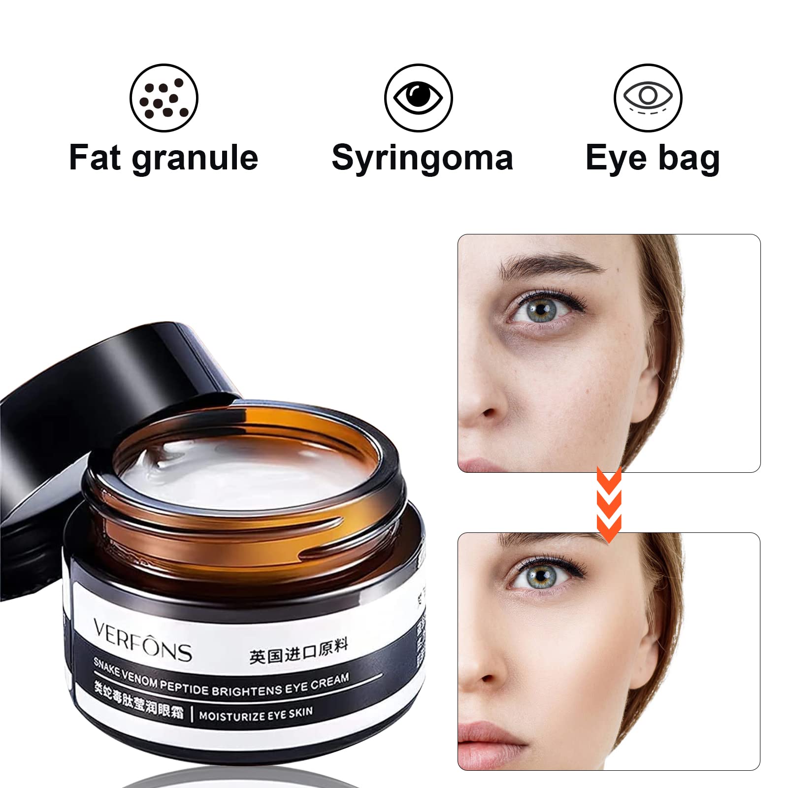 2PCS Verfons Firming Eye Cream - Anti Aging Eye Bag Treatment, Instant Remove Dark Circles & Wrinkles | Snake Venom Formula for Puffy Eyes & Fine Lines | Perfect for Morning Routine & Night Care